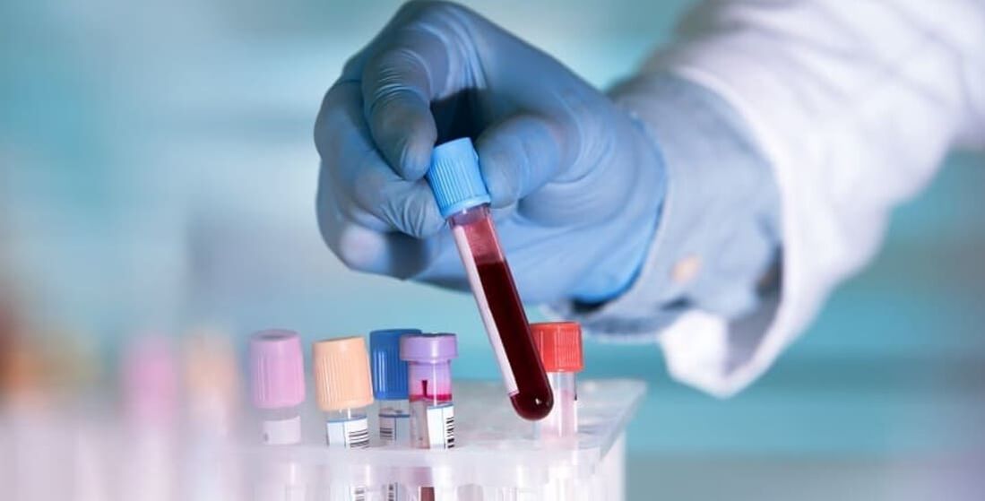 How does alcohol affect blood tests 
