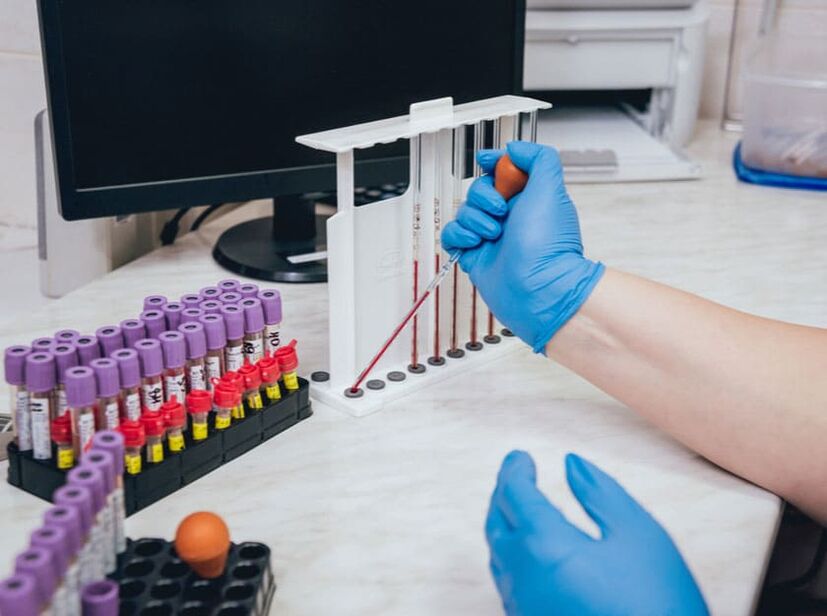 Measure blood sugar after drinking alcohol
